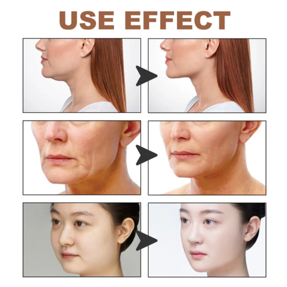 Cinta Lifting Facial